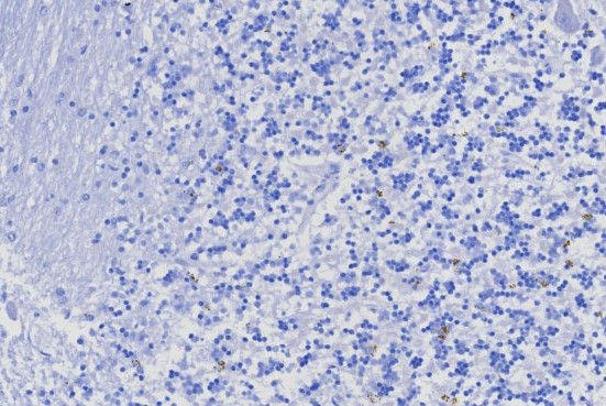IHC analysis of formalin-fixed, paraffin-embedded human brain. Negative tissue control using TRPS1 antibody (TRPS1/8131R) at 2ug/ml in PBS for 30min RT. HIER: Tris/EDTA, pH9.0, 45min. Secondary: HRP-polymer, 30min. DAB, 5min.
