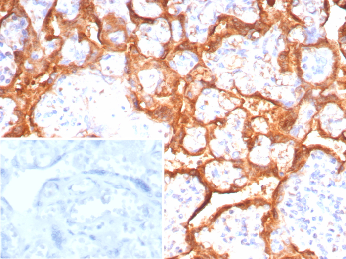 Formalin-fixed, paraffin-embedded human placenta stained with Growth Hormone antibody (GH/8215R). Inset: PBS instead of primary antibody; secondary only negative control.