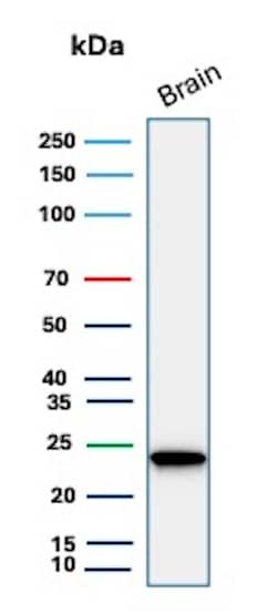 Western Blot Analysis of human brain tissue lysate using UCH-L1/PGP9.5 Antibody (rUCHL1/8133). 