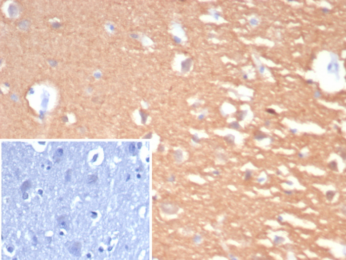 ormalin-fixed, paraffin-embedded human cerebellum stained withUCH-L1/PGP9.5 antibody (UCHL1/7076R) Inset: PBS instead of primary antibody; secondary only negative control