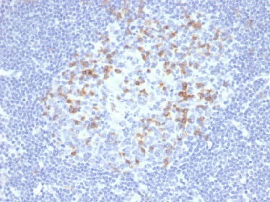Formalin-fixed, paraffin-embedded human lymph node stained with PD1 (CD279) Recombinant Rabbit Monoclonal Antibody (PDCD1/4231R). HIER: Tris/EDTA, pH9.0, 45min. 2: HRP-polymer, 30min. DAB, 5min.