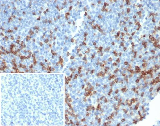Formalin-fixed, paraffin-embedded human tonsil stained with PD1 (CD279) Recombinant Rabbit Monoclonal Antibody (PDCD1/4231R). Inset: PBS instead of primary antibody; secondary only negative control.