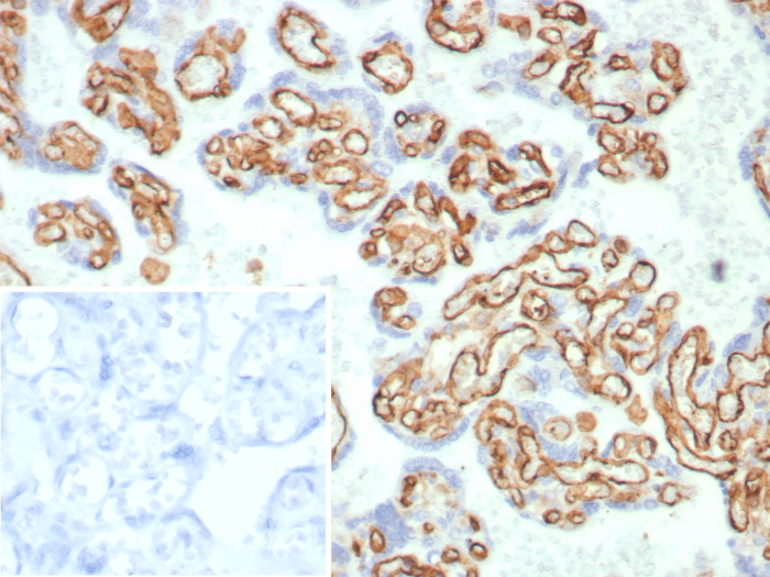 Formalin-fixed, paraffin-embedded human placenta stained with CD31/PECAM-1 antibody (C31/8359R). Inset: PBS instead of primary antibody; secondary only negative control.