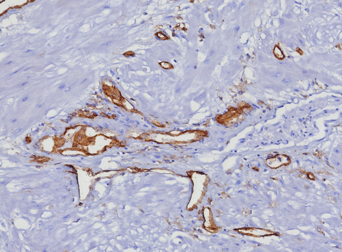 Formalin-fixed, paraffin-embedded human uterus stained with CD31/PECAM-1 antibody (C31/8377R). HIER: Tris/EDTA, pH9.0, 45min. Secondary: HRP-polymer, 30min. DAB, 5min.