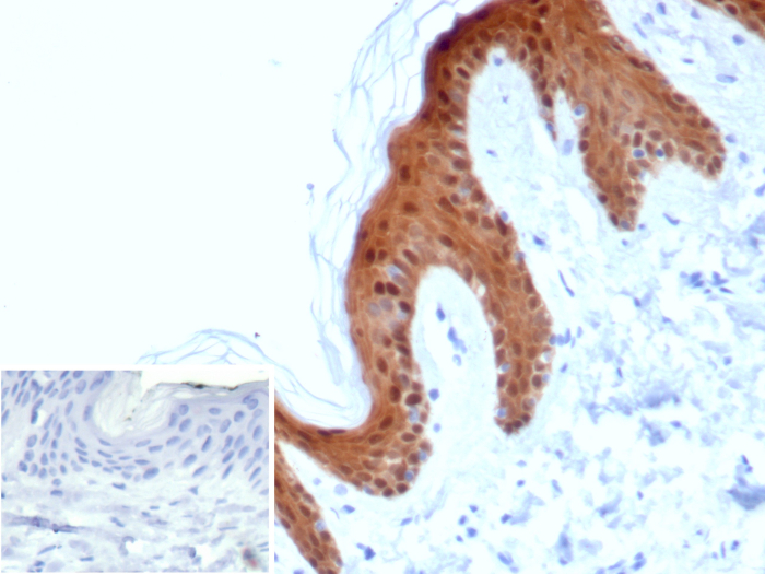 Formalin-fixed, paraffin-embedded human skin stained with Serpin B5/Maspin antibody (SERPINB5/4978). Inset: PBS instead of primary antibody; secondary only negative control.