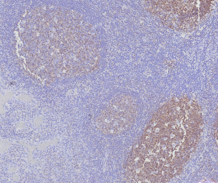 Formalin-fixed, paraffin-embedded human tonsil stained with BOB1 antibody (BOB1/7469). HIER: Tris/EDTA, pH9.0, 45min. Secondary: HRP-polymer, 30min. DAB, 5min.