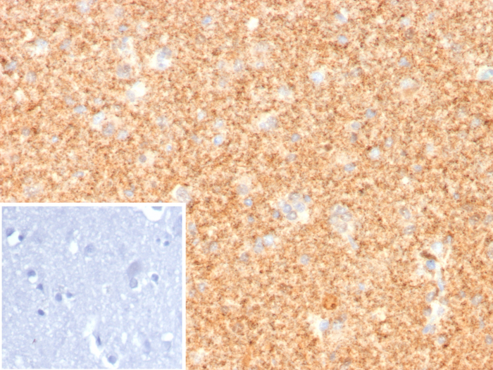 Formalin-fixed, paraffin-embedded human cerebellum stained with UCH-L1/PGP9.5 antibody (UCHL1/8107R). Inset: PBS instead of primary antibody; secondary only negative control.