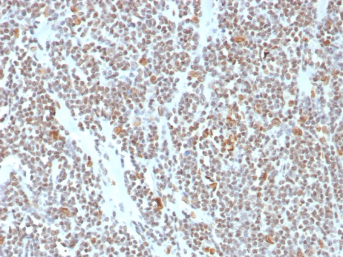 Formalin-fixed, paraffin-embedded human colon stained with ATRX antibody (ATRX/7940). HIER: Tris/EDTA, pH9.0, 45min. Secondary: HRP-polymer, 30min. DAB, 5min.
