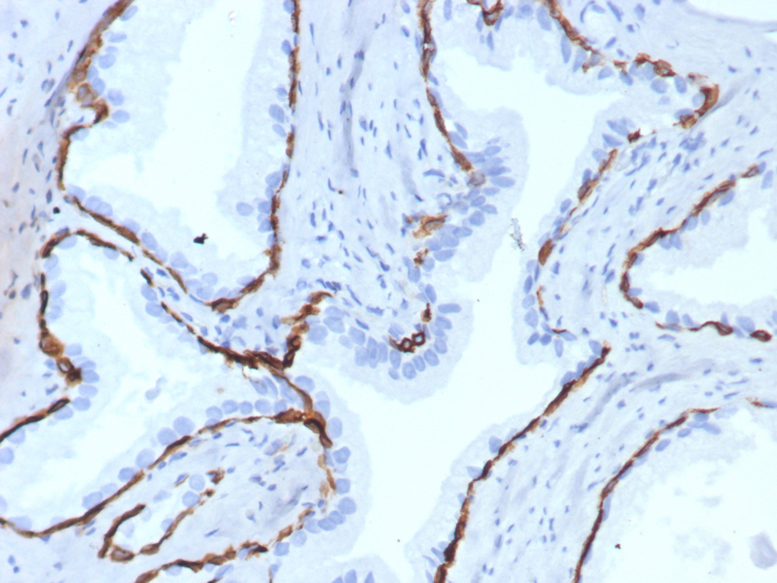 Formalin-fixed, paraffin-embedded human prostate stained with Cytokeratin 14 antibody (KRT14/7977R). HIER: Tris/EDTA, pH9.0, 45min. Secondary: HRP-polymer, 30min. DAB, 5min.