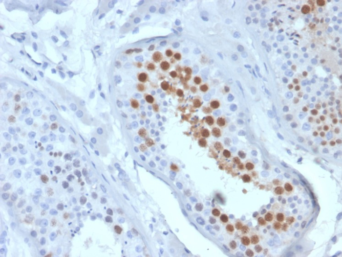 Formalin-fixed, paraffin-embedded human testis stained with KIF2C antibody (KIF2C/6519) at 2ug/ml. HIER: Tris/EDTA, pH9.0, 45min. Secondary: HRP-polymer, 30min. DAB, 5min.