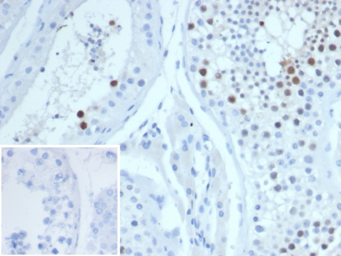 Formalin-fixed, paraffin-embedded human testis stained with KIF2C antibody (KIF2C/6519) at 2ug/ml. Inset: PBS instead of primary antibody; secondary only negative control.