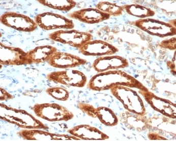 Formalin-fixed, paraffin-embedded human kidney stained with Creatine Kinase BB antibody (CKBB/6565).