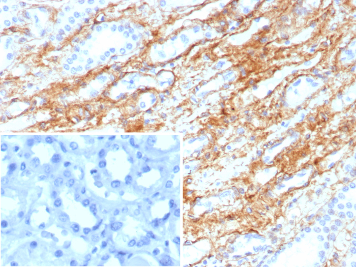 Formalin-fixed, paraffin-embedded human kidney stained with Collagen IV antibody (COL4/8657R). Inset: PBS instead of primary antibody; secondary only negative control.