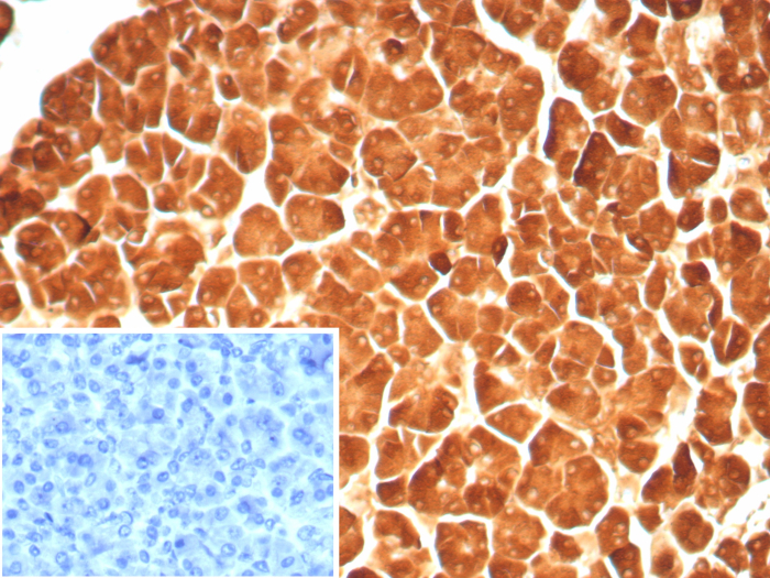 Formalin-fixed, paraffin-embedded human pancreas stained with Carboxypeptidase A1/CPA1 antibody (rCPA1/8688). Inset: PBS instead of primary antibody; secondary only negative control.