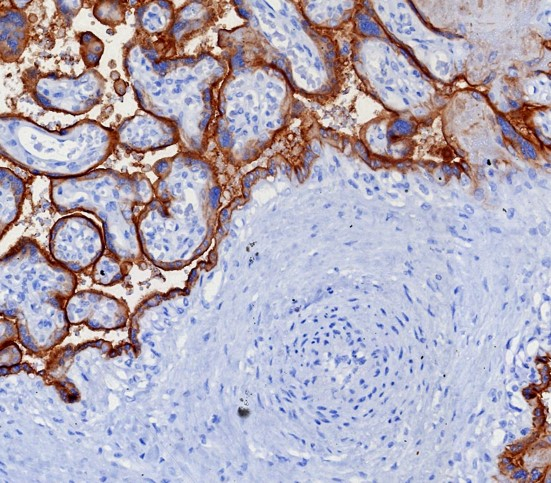 Formalin-fixed, paraffin-embedded human placenta stained with PD-L1 antibody (PDL1/7568R). HIER: Tris/EDTA, pH9.0, 45min. Secondary: HRP-polymer, 30min. DAB, 5min.