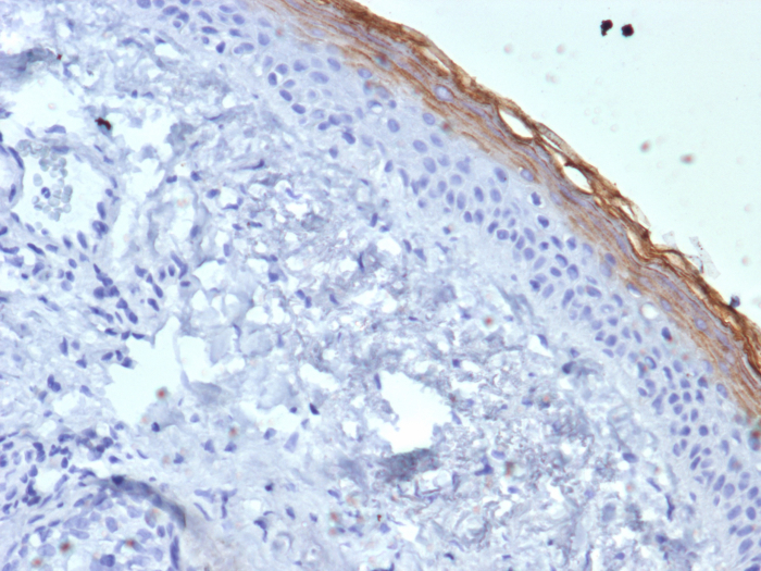 Formalin-fixed, paraffin-embedded human skin stained with Kallikrein 7 antibody (KLK7/4692). HIER: Tris/EDTA, pH9.0, 45min. Secondary: HRP-polymer, 30min. DAB, 5min.