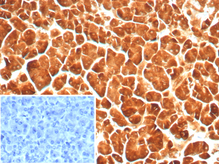 Formalin-fixed, paraffin-embedded human pancreas stained with Carboxypeptidase A1/CPA1 antibody (rCPA1/8689). Inset: PBS instead of primary antibody; secondary only negative control.