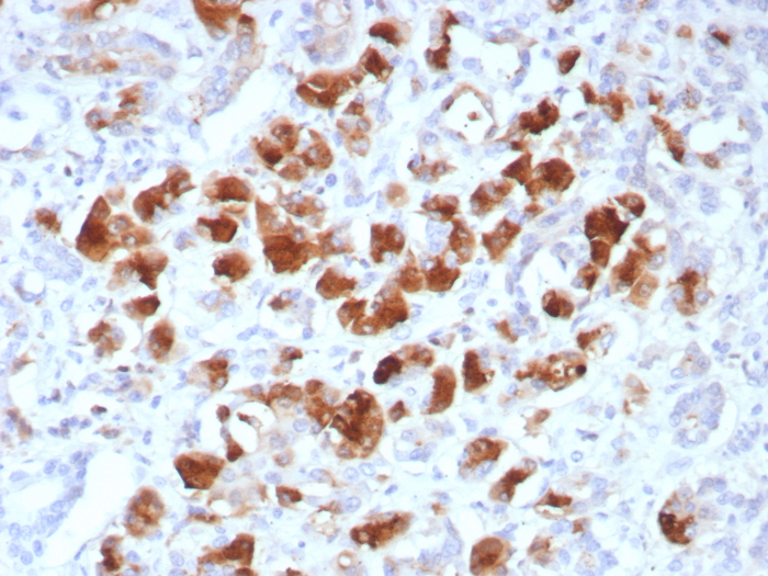 Formalin-fixed, paraffin-embedded human pancreas stained with Carboxypeptidase A1/CPA1 antibody (rCPA1/8518). HIER: Tris/EDTA, pH9.0, 45min. Secondary: HRP-polymer, 30min. DAB, 5min.