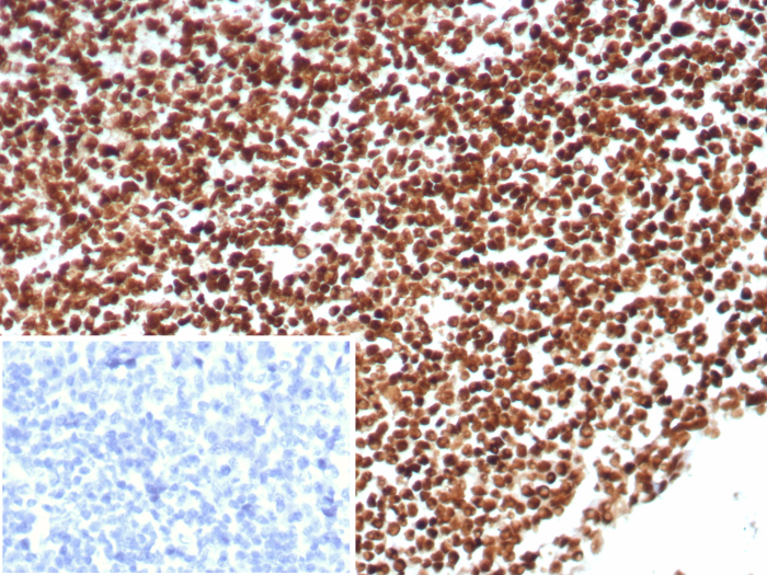 Formalin-fixed, paraffin-embedded human tonsil stained with Ku80/XRCC5 antibody (XRCC5/8703R). Inset: PBS instead of primary antibody; secondary only negative control.