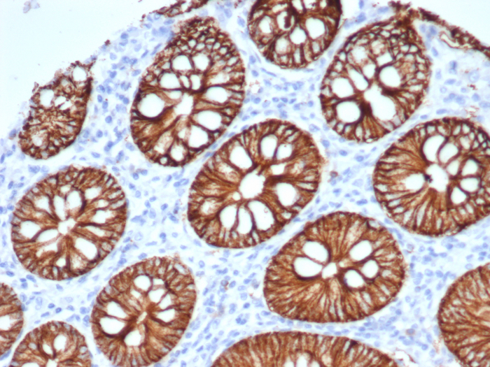 Formalin-fixed, paraffin-embedded human normal colon stained with S100 calcium binding protein A14 antibody (S100A14/7401). HIER: Tris/EDTA, pH9.0, 45min. Secondary: HRP-polymer, 30min. DAB, 5min.