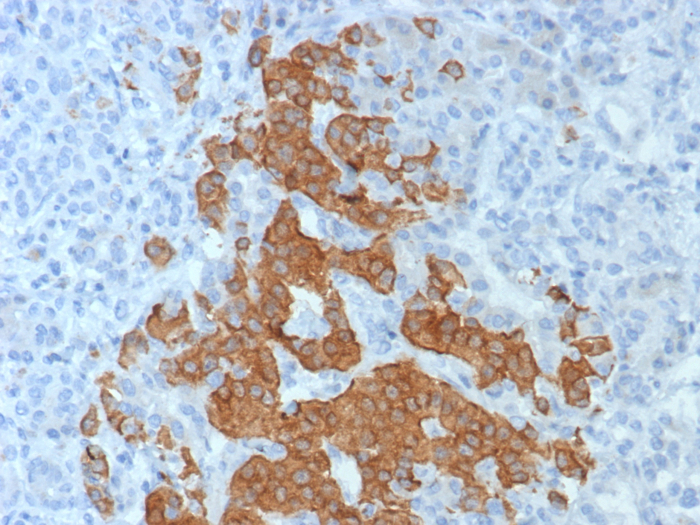 Formalin-fixed, paraffin-embedded human pancreas stained with GAD2/GAD65 antibody (GAD2/8394R). HIER: Tris/EDTA, pH9.0, 45min. Secondary: HRP-polymer, 30min. DAB, 5min.