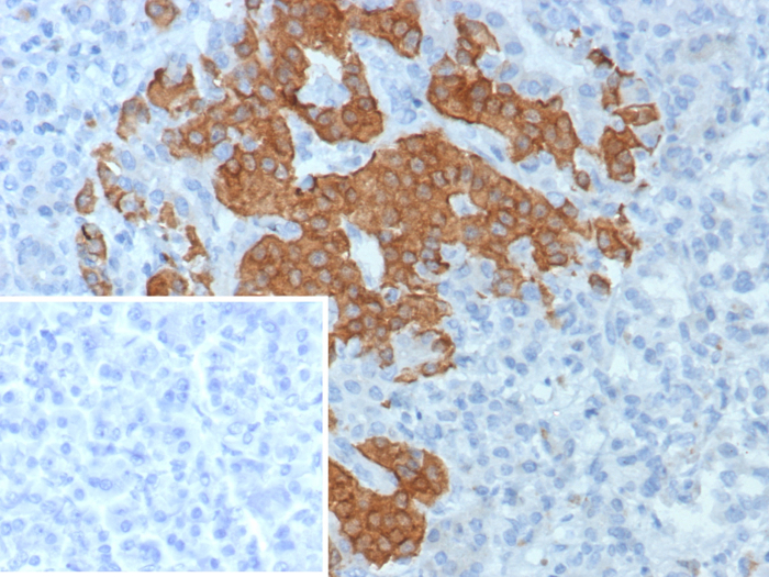 Formalin-fixed, paraffin-embedded human pancreas stained with GAD2/GAD65 antibody (GAD2/8394R). Inset: PBS instead of primary antibody; secondary only negative control.