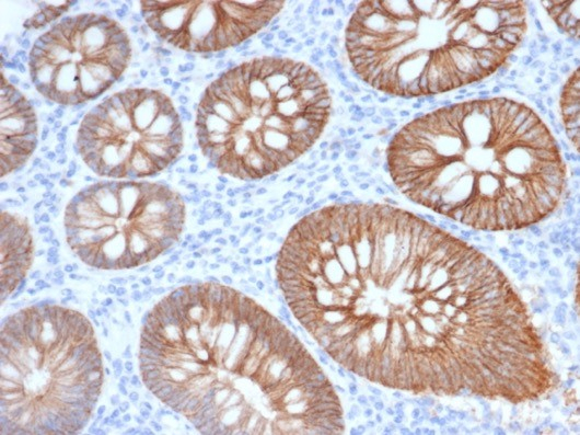 Formalin-fixed, paraffin-embedded human normal colon stained with S100 calcium binding protein A14 antibody (S100A14/7402). HIER: Tris/EDTA, pH9.0, 45min. Secondary: HRP-polymer, 30min. DAB, 5min.