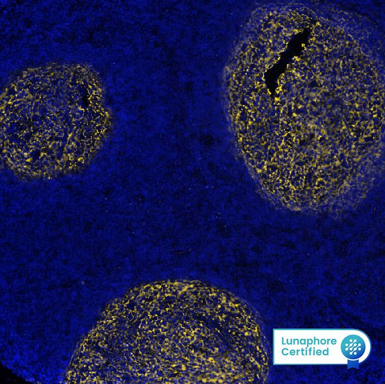 embedded sections of human Hodgkin's Lymphoma using Mouse Anti-Human CD21, Monoclonal Antibody (Catalog # NBP3-26866) at 1:800 at 37° Celsius for 4 minutes. Before incubation with the primary antibody, tissue underwent an all-in-one dewaxing and antigen r