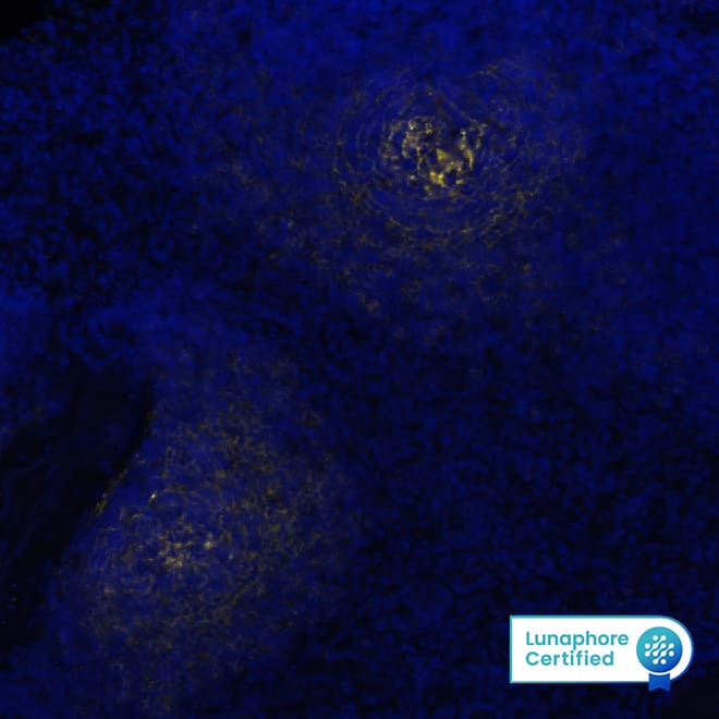 CD21 was detected in immersion fixed paraffin-embedded sections of human Spleen using Mouse Anti-Human CD21, Monoclonal Antibody (Catalog # NBP3-26866) at 1:800 at 37° Celsius for 4 minutes. Before incubation with the primary antibody, tissue underwent an all-in-one dewaxing and antigen retrieval preprocessing using PreTreatment Module (PT Module)and Dewax and HIER Buffer H (pH 9; Epredia Catalog #TA-999-DHBH). Tissue was stained using the Alexa Fluor™ 647 Goat anti-Mouse IgG Secondary Antibody at 1:200 at 37 ° Celsius for 2 minutes. (Yellow; Lunaphore Catalog # DR647MS) and counterstained with DAPI (blue; Lunaphore Catalog # DR100). Specific staining was localized to the membrane. Protocol available in COMET™ Panel Builder.