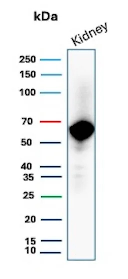 Western Blot Analysis of human kidney tissue lysate using Occludin Antibody (rOCLN/8776).