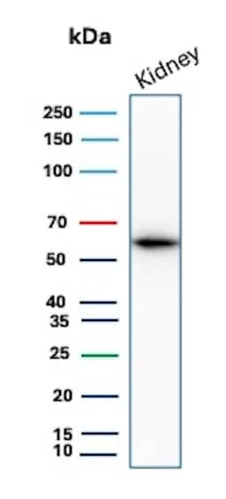 Western Blot Analysis of human kidney tissue lysate using Occludin Antibody (rOCLN/8525).