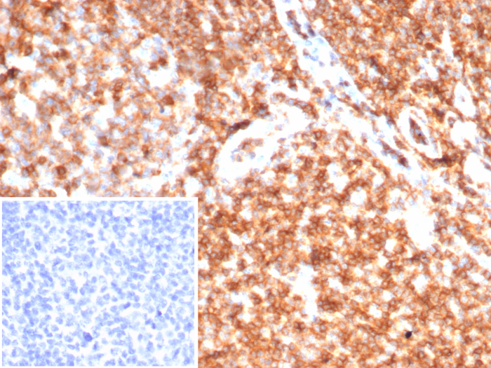 Formalin-fixed, paraffin-embedded human tonsil stained with CD45 antibody (rPTPRC/7275). Inset: PBS instead of primary antibody; secondary only negative control.