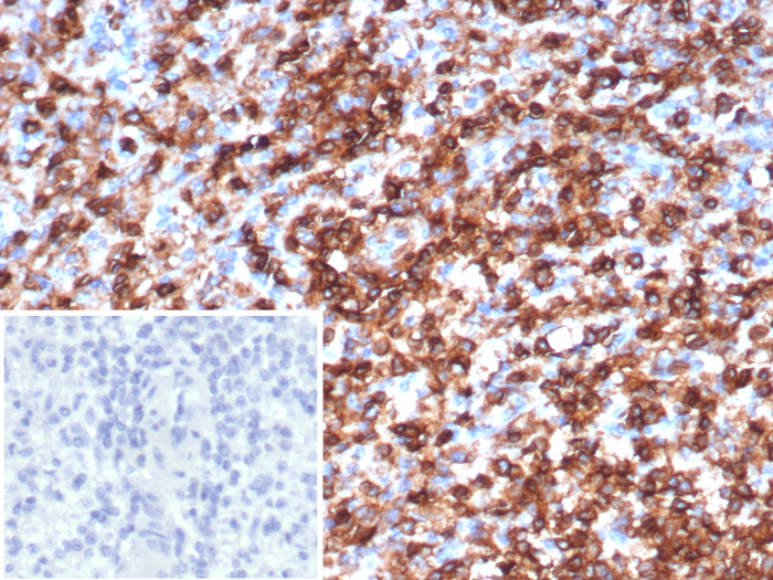 Formalin-fixed, paraffin-embedded human spleen stained with CD45 antibody (rPTPRC/1147). Inset: PBS instead of primary antibody; secondary only negative control.