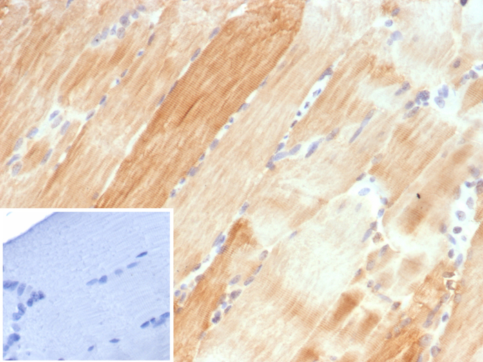 Formalin-fixed, paraffin-embedded human skeletal muscle stained with AlphaB Crystallin/CRYAB antibody (CRYAB/4661). Inset: PBS instead of primary antibody; secondary only negative control.