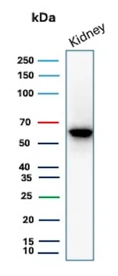Western Blot Analysis of human kidney tissue lysate using Occludin Antibody (OCLN/8526R).