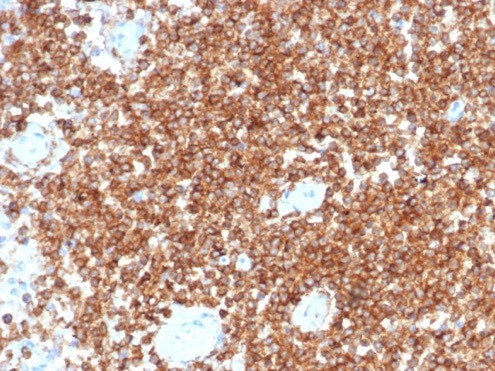 Formalin-fixed, paraffin-embedded human tonsil stained with CD45RA antibody (PTPRC/4367R). HIER: Tris/EDTA, pH9.0, 45min. Secondary: HRP-polymer, 30min. DAB, 5min.