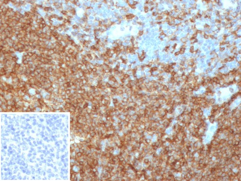 Formalin-fixed, paraffin-embedded human tonsil stained with CD45RA antibody (PTPRC/4367R). Inset: PBS instead of primary antibody; secondary only negative control.