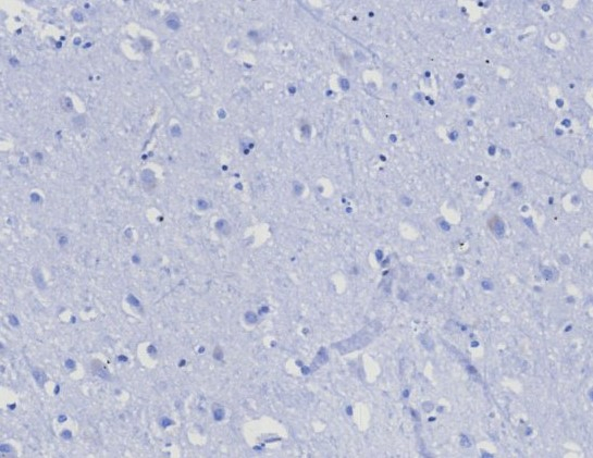 IHC analysis of formalin-fixed, paraffin-embedded human brain. Negative tissue control using CD45RA antibody (PTPRC/8124R) at 2ug/ml in PBS for 30min RT. HIER: Tris/EDTA, pH9.0, 45min. Secondary: HRP-polymer, 30min. DAB, 5min.