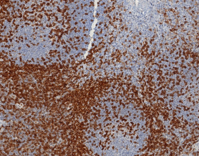 Formalin-fixed, paraffin-embedded human tonsil stained with CD45RA antibody (PTPRC/8124R). HIER: Tris/EDTA, pH9.0, 45min. Secondary: HRP-polymer, 30min. DAB, 5min.