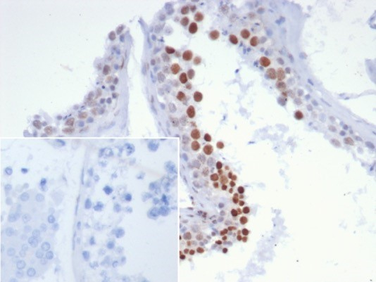 Formalin-fixed, paraffin-embedded human testis stained with SNURPORTIN1 antibody (SNUPN/7363R). Inset: PBS instead of primary antibody; secondary only negative control.