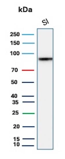 Western Blot Analysis of human Small Intestine tissue lysate using Cadherin-17 Antibody (CDH17/8515R).