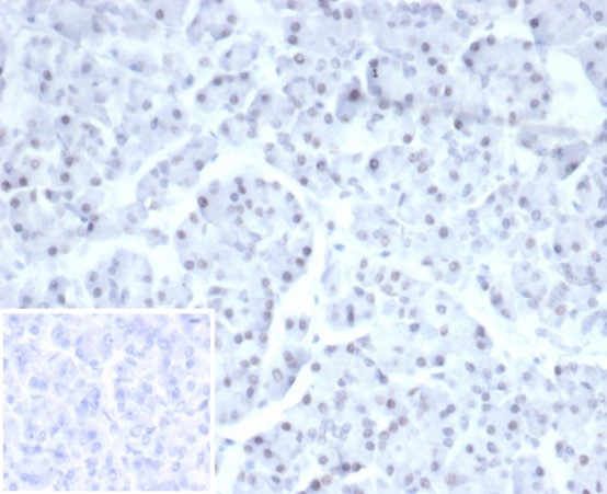 Formalin-fixed, paraffin-embedded human pancreas stained with PHOX2B antibody (PHOX2B/7161R). Inset: PBS instead of primary antibody; secondary only negative control.