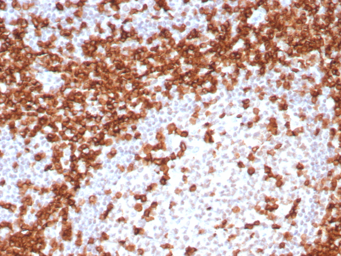 Formalin-fixed, paraffin-embedded human tonsil stained with CD45RA antibody (T200/8144R). HIER: Tris/EDTA, pH9.0, 45min. Secondary: HRP-polymer, 30min. DAB, 5min.