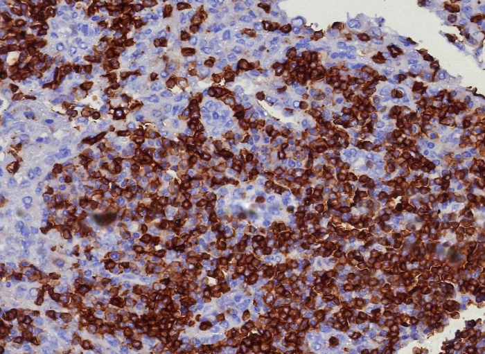 Formalin-fixed, paraffin-embedded human lymph node stained with CD45RA antibody (PTPRC/8341R). HIER: Tris/EDTA, pH9.0, 45min. Secondary: HRP-polymer, 30min. DAB, 5min.