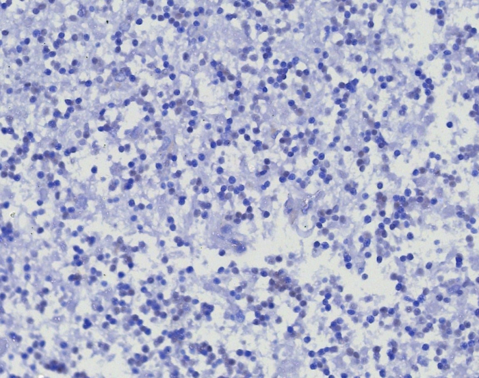 IHC analysis of formalin-fixed, paraffin-embedded human brain. Negative tissue control using CD45RA antibody (PTPRC/8341R) at 2ug/ml in PBS for 30min RT. HIER: Tris/EDTA, pH9.0, 45min. Secondary: HRP-polymer, 30min. DAB, 5min.