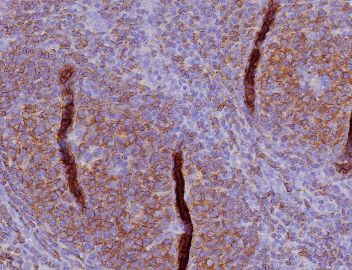 Formalin-fixed, paraffin-embedded human tonsil stained with CD45RA antibody (PTPRC/8341R). HIER: Tris/EDTA, pH9.0, 45min. Secondary: HRP-polymer, 30min. DAB, 5min.