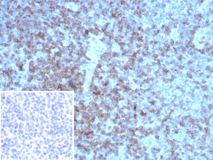 IHC analysis of formalin-fixed, paraffin-embedded human tonsil. Cell surface stained with CD2 antibody (rLFA2/8516) Inset: PBS instead of primary antibody; secondary only negative control.