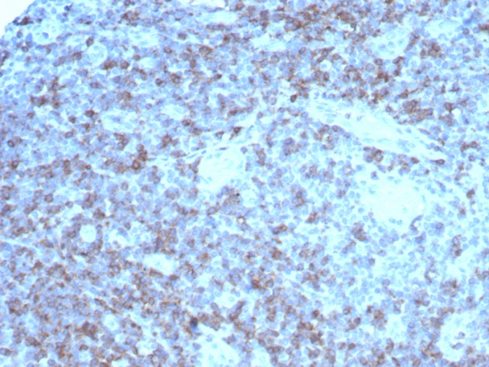 IHC analysis of formalin-fixed, paraffin-embedded human colon. Cell surface stained with CD2 antibody (rLFA2/8516)HIER: Tris/EDTA, pH9.0, 45min. Secondary: HRP-polymer, 30min. DAB, 5min.