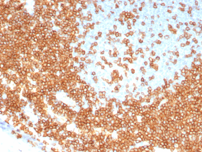 Formalin-fixed, paraffin-embedded human tonsil stained with CD3 epsilon antibody (C3e/8115R). HIER: Tris/EDTA, pH9.0, 45min. Secondary: HRP-polymer, 30min. DAB, 5min.