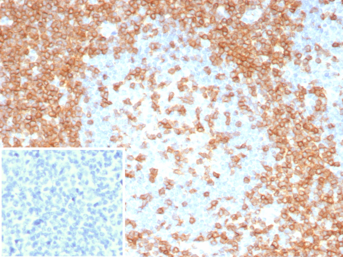 Formalin-fixed, paraffin-embedded human tonsil stained with CD3 epsilon antibody (C3e/8115R). Inset: PBS instead of primary antibody; secondary only negative control.